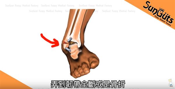 季后赛带伤作战！杰威接受右手韧带撕裂修复手术的简单介绍